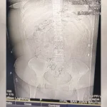 Detienen a mujer que transportaba droga en cápsulas desde La Quiaca