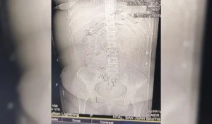 Detienen a mujer que transportaba droga en cápsulas desde La Quiaca