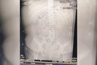 Detienen a mujer que transportaba droga en cápsulas desde La Quiaca