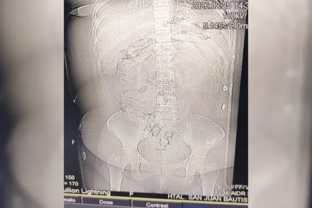 Detienen a mujer que transportaba droga en cápsulas desde La Quiaca