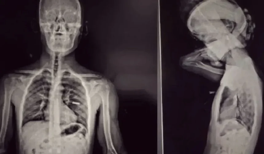 Dos mulas detenidas con cocaína en La Quiaca: 192 cápsulas incautadas