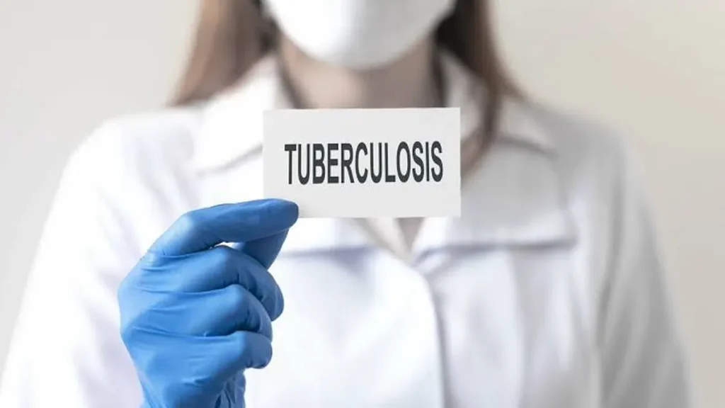 Salta acumula 400 casos de tuberculosis y detalla los síntomas