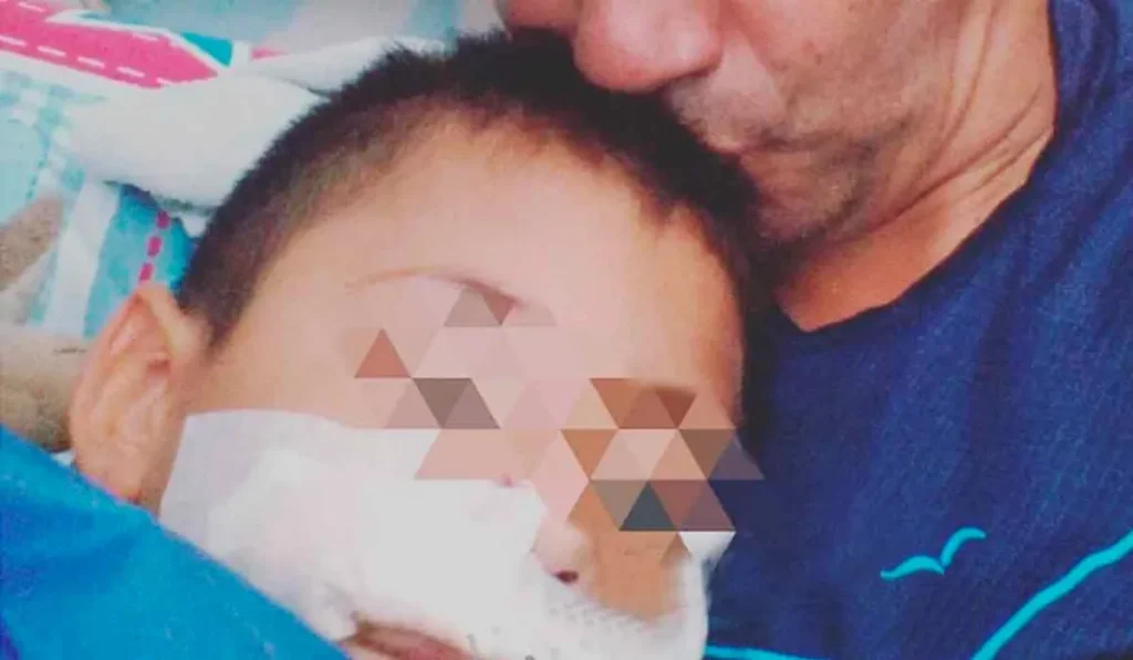 Ataque de perro en San Pedro: un niño de 7 años sufrió heridas en el rostro